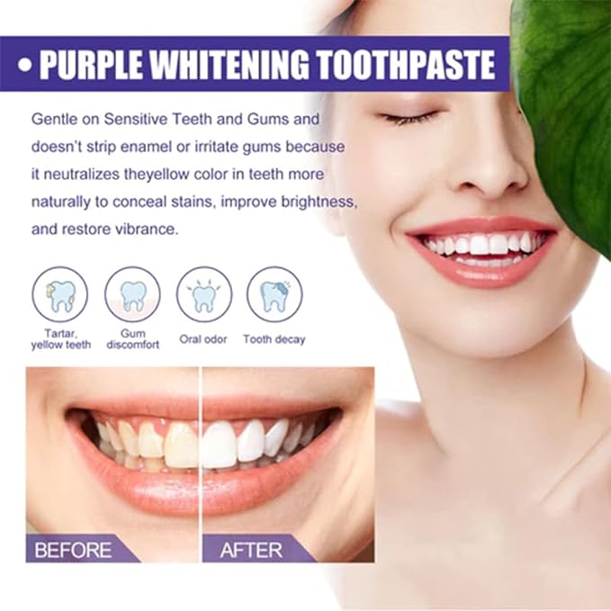 Toothpaste for Teeth Whitening (120g)