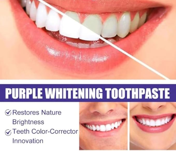 Toothpaste for Teeth Whitening (120g)