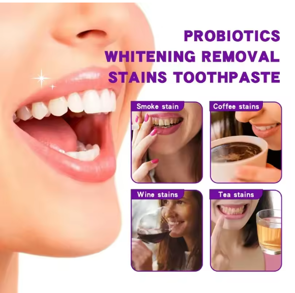 Toothpaste for Teeth Whitening (120g)